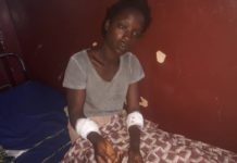 Labé : pour une question de dépense, un homme bat sa femme et lui casse les deux bras