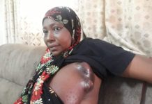 Conakry : SOS pour madame Sayon Camara qui traîne une tumeur maligne depuis un an