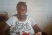 Faranah: ce cri de cœur de dame Adama Condé, mère d’un bébé atteint de l’éléphantiasis