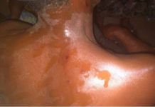 Forte pluie à Labé: une décharge électrique fait trois blessés dans la commune urbaine