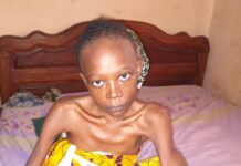 Atteinte d’une tumeur, Oumou Barry demande de l’aide à l’Etat et aux bonnes volontés