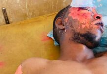 Un jeune électrocuté par un poteau de haute tension à Siguiri: retour sur le drame