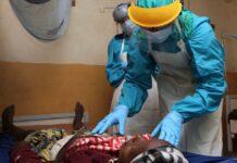 Santé : un cas confirmé de Fièvre Lassa détecté à Guéckédou (ANSS)