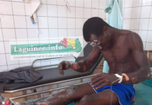 Kouroussa/Cisséla : Aguibou Diabaté brûlé dans sa maison à cause d’une boîte herbicide