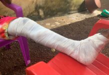 Violences sur l’axe : témoignage émouvant d’Ismaël Bah, 16 ans, qui a reçu une balle à Bambéto