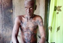 Faranah : SOS pour Alseny Camara souffrant d’une maladie inconnue depuis plus de 7 ans