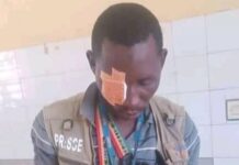 Siguiri : un journaliste de Djoma battu à sang par des policiers, ses matériels de travail endommagés (URTELGUI)
