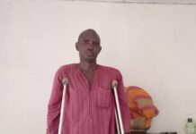 Crimes sous Alpha Condé : témoignage glacial d’une victime qui a reçu une balle à la jambe