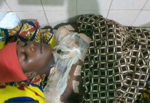 Mamou : à cause d’une tasse de thé, une femme verse de l’eau chaude sur sa coépouse à Thieougol