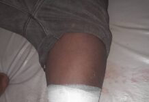 Siguiri: Poursuivis par des bandits, deux jeunes orpailleurs frôlent la mort à Mofrayah