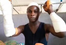 Affrontement à Gbérédou Baranama : le témoignage poignant de Kaba Condé, rescapé de la violence