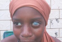 SOS – Sauvons Aissatou Lamarana Diallo avant qu’il ne soit trop tard !