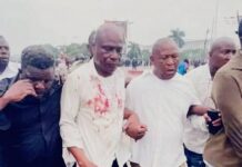 RDC : deux figures de l’opposition blessées lors d’une manifestation contre la révision constitutionnelle à Kinshasa