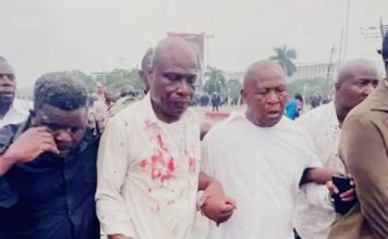 RDC : deux figures de l’opposition blessées lors d’une manifestation contre la révision constitutionnelle à Kinshasa